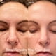 thumbnail image 4 of Varita de terapia de luz roja Solawave Radiant Renewal 4 en 1, 4 of 9