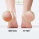 thumbnail image 5 of Aceite de árbol de té Foot Soak DAILY REMEDY con sal de Epsom, paquete de 2, 5 of 9