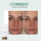 thumbnail image 4 of Mascarilla de Gel IMAGE Skincare 59 ml ORMEDIC Equilibrante, 4 of 7