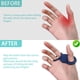 thumbnail image 2 of Protectores de pulgar de béisbol y softbol de silicona suave de 2 paquetes para absorción de golpes, prevención de ampollas, reducción de picaduras de murciélagos para el entrenamiento de ba, 2 of 3