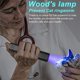thumbnail image 2 of Linterna Wood's Lamp de luz negra para mascotas, gatos y perros, 2 of 6