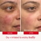 thumbnail image 4 of Crema hidratante First Aid Beauty Ultra Repair, 240 ml, 4 of 9