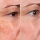 thumbnail image 4 of Sérum facial MSGbcg Ageless Rejuvenate con vitamina C y ácido hialurónico, 4 of 8