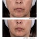 thumbnail image 4 of Mascarilla de Noche Noble Panacea Las 8 Dosis Excepcionales, 4 of 9