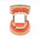 thumbnail image 1 of Dental Pathological Typodont Teeth Model Periodontics Implant Endodontic Caries Treatment Typodont Model Adult Children Teeth, 1 of 3