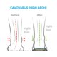 thumbnail image 3 of Plantillas Ortopédicas para Zapatos FootScientific Arcos Tipo 3, 3 of 5