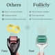 thumbnail image 2 of Microagujas Derma Roller Follicly Professional, 192 agujas, 2 of 7