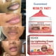 thumbnail image 3 of Lips Pink Fresh Lightening Bleaching Cream Treatment Remove Dark Lips Lip Balm Hydrating Moisturizer Nourishing Essence, 3 of 3