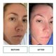 thumbnail image 5 of Almohadillas exfoliantes faciales Replenix Glycolic Acid 10% (60 unidades), 5 of 7