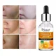 thumbnail image 4 of Kit Skincare DISAAR Vitamina C Hidratante/ Rejuvenecimiento, 4 of 7