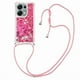 thumbnail image 1 of Funda FOXDOCK para Xiaomi POCO M6 Pro 4G con Cuerda Ajustable, Brillo Líquido, Protección Antigolpes y Lente – Ideal para Regalo, 1 of 6