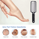 thumbnail image 4 of Lima para pies, removedor de callos, raspador para pies, el mejor exfoliante para pies secos, elimina durezas., 4 of 5