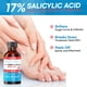 thumbnail image 3 of Removedor de callos Aemerry con 17% de ácido salicílico, 30 ml, 3 of 8