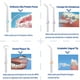 thumbnail image 2 of Irrigador Bucal Waterpiks Limpiador Dental Portatil Higiene Negro, 2 of 7