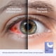 thumbnail image 4 of Mascarilla térmica para ojos CorneaCare Rest, compresa caliente autocalentable, 4 of 9