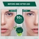 thumbnail image 2 of Mascarilla para debajo de los ojos SERSANVE con extracto de té verde antienvejecimiento, 30 pares, 2 of 3