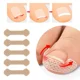 thumbnail image 2 of 10pcs Nail Correcting Stickers Toenail Corrector Ingrowing Toenail Adult Student Toenail Groove Treatment Supplies, 2 of 3