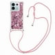 thumbnail image 1 of Funda FOXDOCK para Xiaomi Redmi Note 13 Pro 5G con Cuerda Ajustable, Brillo Líquido, Protección Antigolpes y Lente – Ideal para Regalo, 1 of 6