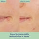 thumbnail image 3 of Solución Puntual Vinopure de Caudalie con Ácido Salicílico 15 ml, 3 of 5