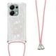 thumbnail image 2 of Funda FOXDOCK para Xiaomi POCO M6 Pro 4G con Cuerda Ajustable, Brillo Líquido, Protección Antigolpes y Lente – Ideal para Regalo, 2 of 6