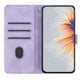 thumbnail image 4 of Funda FOXDOCK para Xiaomi Poco X6 Pro -Diseño elegante,Ideal para hombres y mujeres, 4 of 5