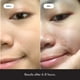 thumbnail image 3 of Parche para Acné Hero Cosmetics Mighty Patch Original 72 Unidades, 3 of 3