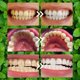 thumbnail image 3 of Polvo Dental LIOZXIUT Restauración Mineral de Dientes 2 Unidades, 3 of 6