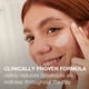 thumbnail image 3 of Tratamiento facial Neutrogena Stubborn Acne AM 75 ml con peróxido de benzoilo al 2,5%, 3 of 7