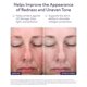 thumbnail image 3 of Sérum facial ALASTIN C-RADICAL Defense 29 ml con vitamina C, 3 of 8