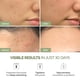 thumbnail image 2 of Mascarilla Facial PLANTIFIQUE Superfood 0.11 kg Corea, 2 of 3