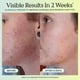 thumbnail image 5 of Serum KraveBeauty Great Barrier Relief, paquete de 2 unidades, 45 ml, 5 of 9