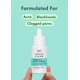 thumbnail image 3 of Serum Rael Miracle Clear, tratamiento completo para el acné, 30 ml, 3 of 6