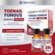 thumbnail image 2 of Tratamiento para Hongos en las Uñas Treatonic 25% Ácido Undecilénico 30 ml, 2 of 9