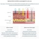 thumbnail image 4 of Mascarilla de cuello con terapia de luz roja LED Anacis, antiarrugas y antienvejecimiento, 4 of 8