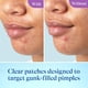 thumbnail image 5 of Parche Tratamiento Facial Differin Power Pimple - 23 unidades, 5 of 9