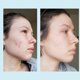 thumbnail image 4 of Gel Peel Perfect Image Ácido glicólico 50% con retinol 30 ml, 4 of 9