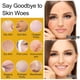thumbnail image 2 of Set de Cuidado Facial Doyeewo Rice Water Hidratante, 2 of 3