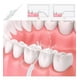 thumbnail image 3 of Set 3 Irrigador Limpiador Dental Agua Presión Brackets Lau, 3 of 3