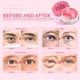 thumbnail image 2 of Parches para debajo de los ojos, gel con cafeína Enaskin Naturals, 30 pares, 2 of 7