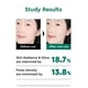 thumbnail image 5 of Mascarilla facial BE+WANTS Seaweed PDRN Peel-Off 100 ml con AHA BHA, 5 of 7