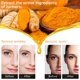 thumbnail image 4 of Serum Kurchugo, corrector de manchas oscuras con cúrcuma, 30 ml, 4 of 9