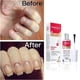 thumbnail image 4 of Tratamiento para uñas MAVALA Stop desalienta el hábito de morderse las uñas 3 x 10 ml, 4 of 6