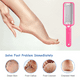 thumbnail image 4 of Lima para pies, removedor de callos, raspador para pies, el mejor exfoliante para pies secos, elimina durezas., 4 of 5