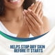 thumbnail image 4 of Crema de manos Gold Bond Healing de 90 ml con aloe Moisture Dura, 4 of 8