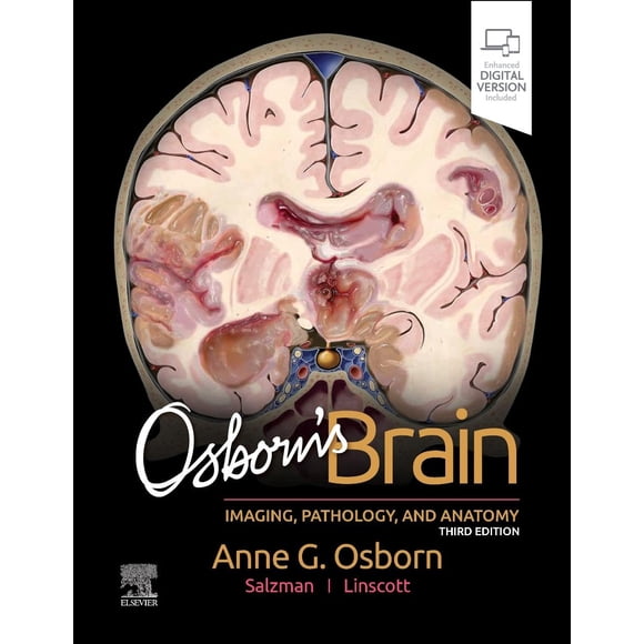 Libro Elsevier Osborn's Brain, Tercera Edición