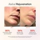 thumbnail image 2 of Sérum activador Solawave Wand Skin Therapy con ácido hialurónico, 2 of 3