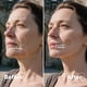 thumbnail image 3 of Exfoliación facial Dermaplane Razor Skinharbor Sonic para mujer, 3 of 9