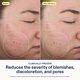thumbnail image 3 of Agente Limpiador Facial Skinfix – Kit Triple Amenaza, 3 of 9