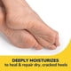 thumbnail image 3 of Perfume Dr. Scholl's Severe Cracked Heel Repair, 75 ml, con 25% de urea, 3 of 3
