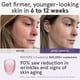 thumbnail image 2 of Mascarilla facial LED Light Therapy iRestore con azul, infrarrojos y rojo, 2 of 9